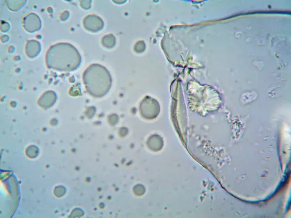 Bacillus coagulans: A Clinically Supported Probiotic for Digestive Health