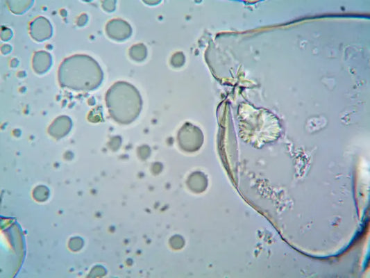 Bacillus coagulans: A Clinically Supported Probiotic for Digestive Health
